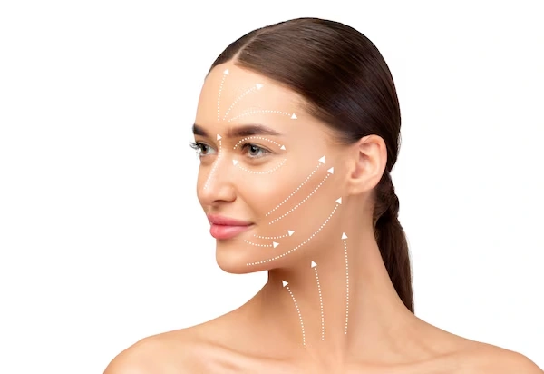Thread Lift